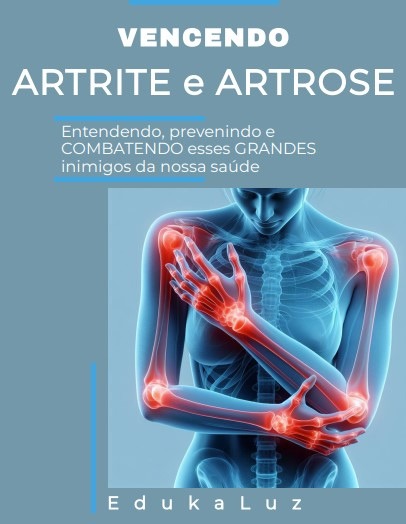 Vencendo Artrite e Artrose - entendendo, prevenindo e combatendo esses grandes inimigos da nossa saúde